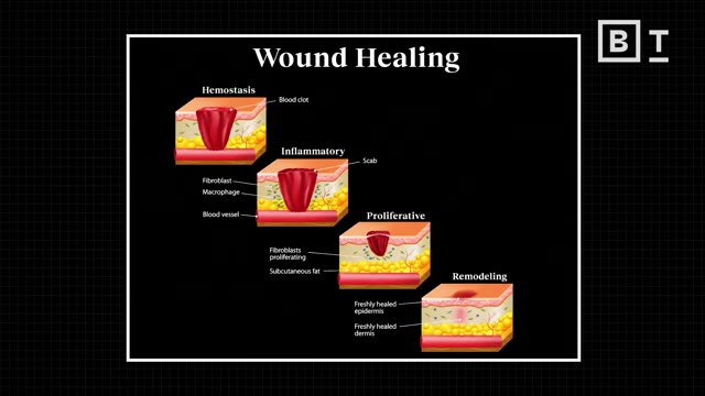 A detailed medical illustration depicts the complex cellular activity beneath a seemingly inactive wound crust.
